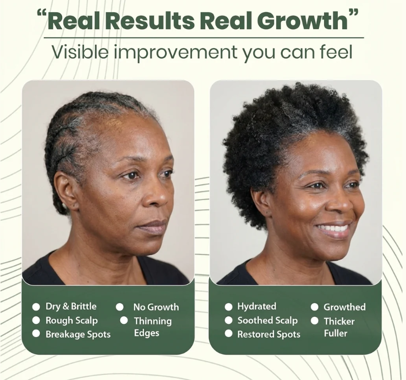 Batana Natural Hair Growth Oil