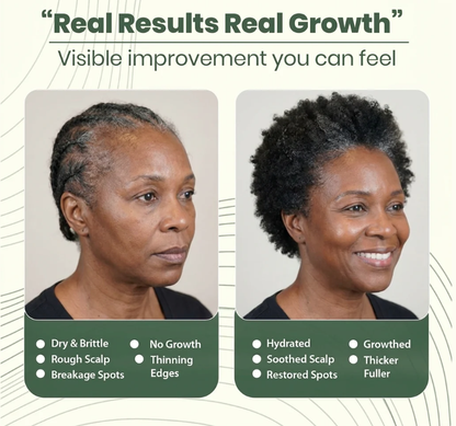 Batana Natural Hair Growth Oil